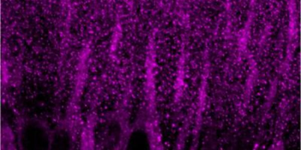 Article teaser image