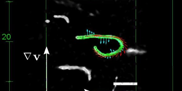 Article teaser image