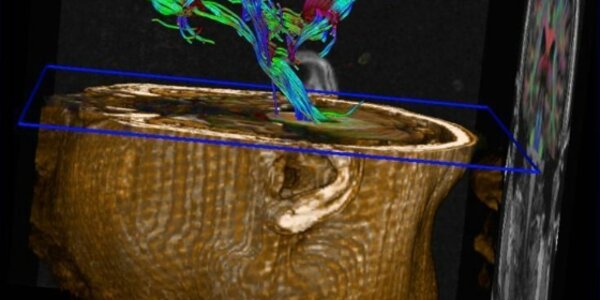 Article teaser image