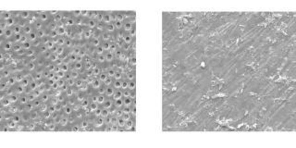 Article teaser image