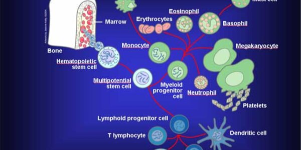 Article teaser image