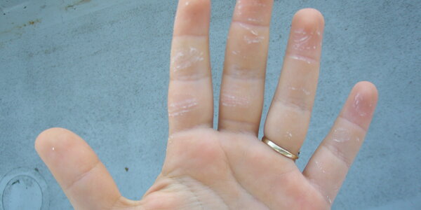 Article teaser image