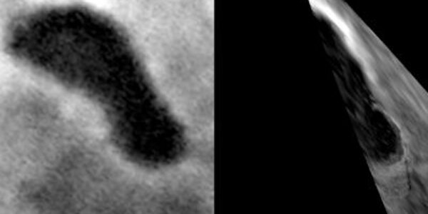 Article teaser image