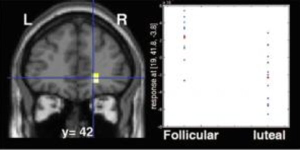 Article teaser image