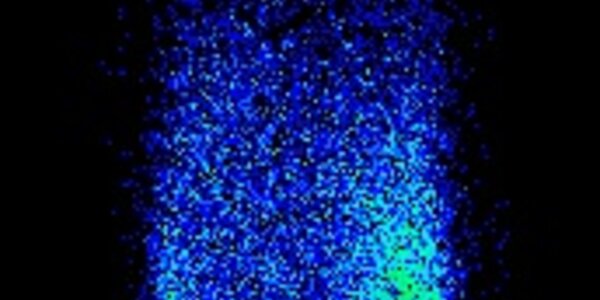 Article teaser image