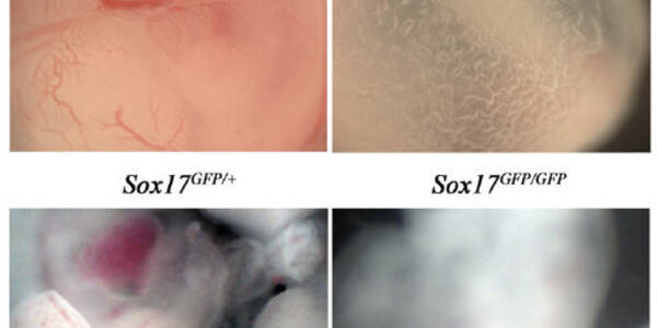 Article teaser image