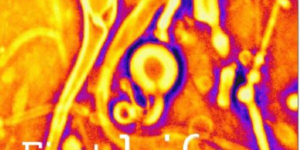 Article teaser image