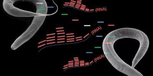 Article teaser image