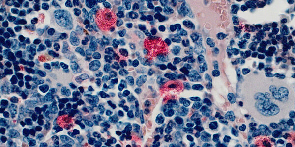 Article teaser image