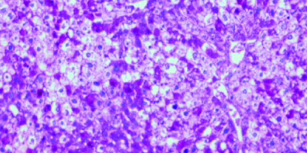 Article teaser image