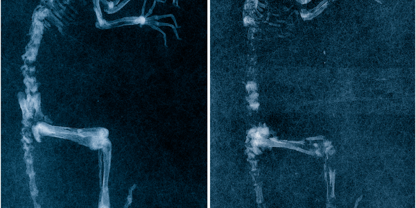 Article teaser image