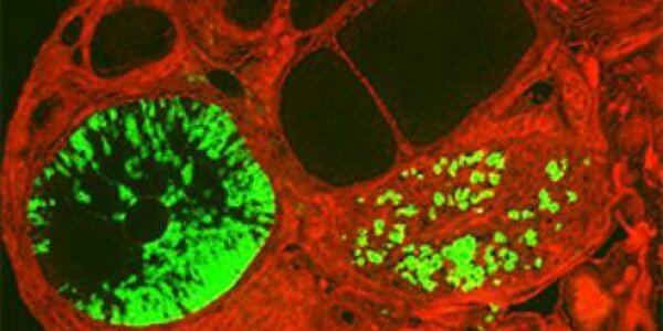 Article teaser image