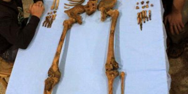 Article teaser image