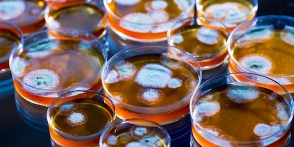 Article teaser image