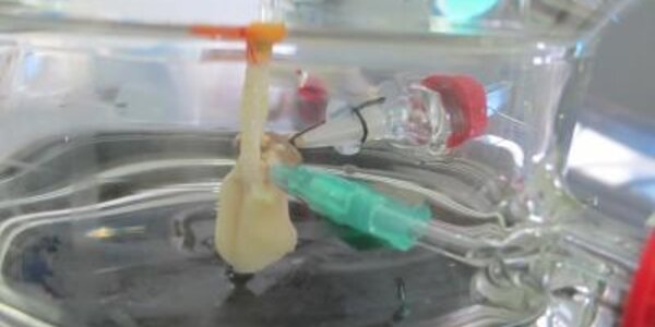 Article teaser image