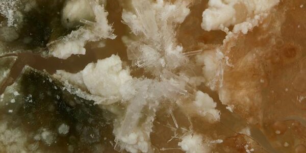 Article teaser image