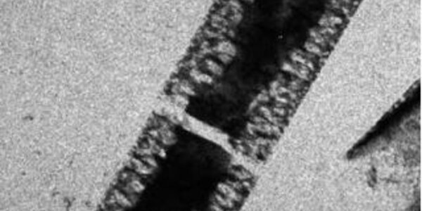 Article teaser image