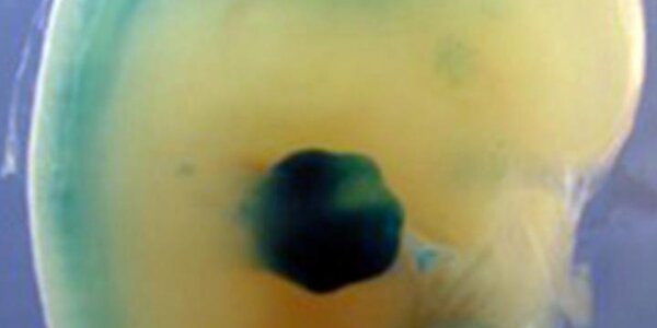 Article teaser image