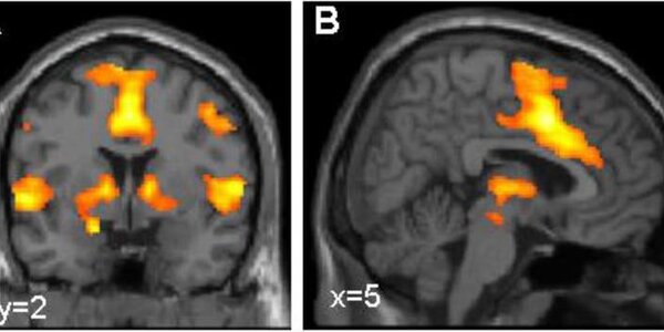 Article teaser image