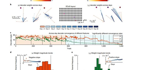 Article teaser image