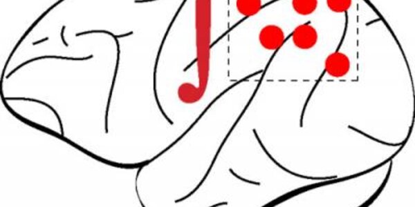 Article teaser image