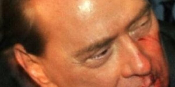 Article teaser image