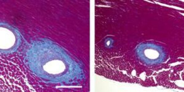 Article teaser image