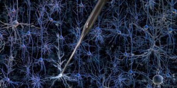 Article teaser image