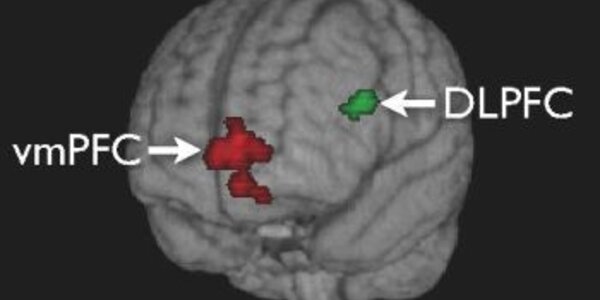 Article teaser image