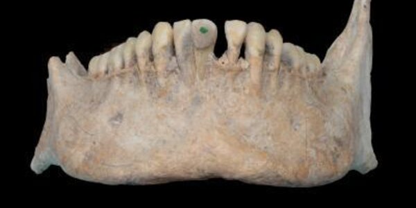 Article teaser image