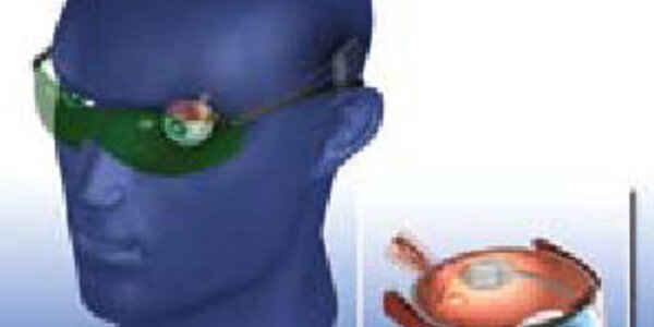 Article teaser image