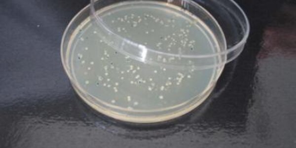 Article teaser image