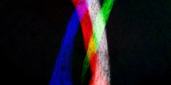 Article teaser image