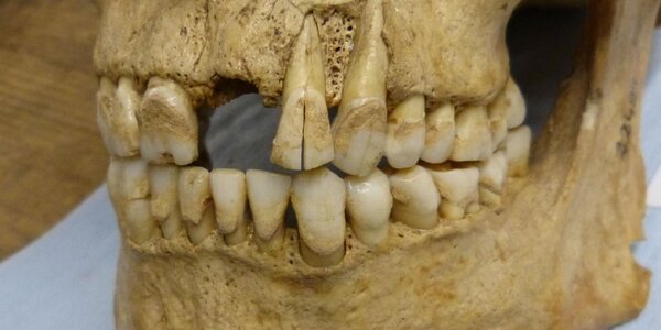 Article teaser image