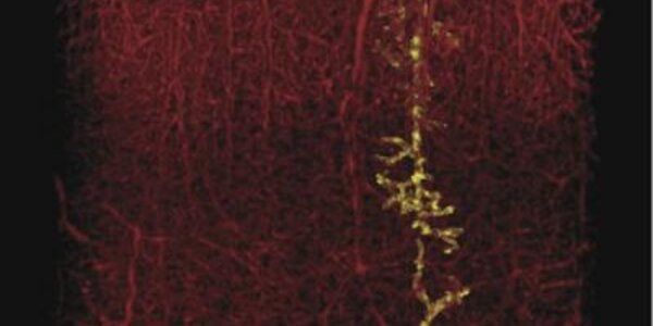 Article teaser image