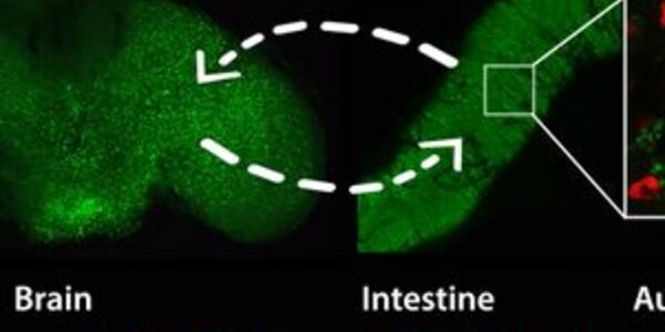 Article teaser image