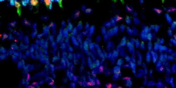 Article teaser image