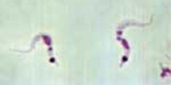 Article teaser image