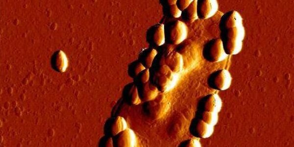 Article teaser image