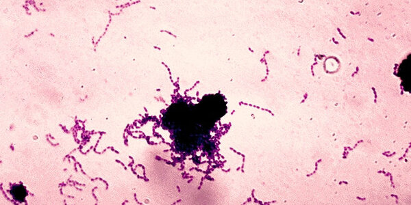 Article teaser image