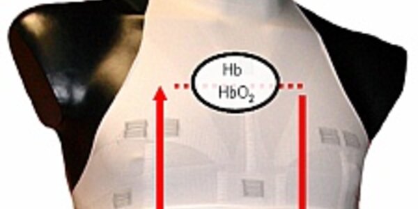 Article teaser image