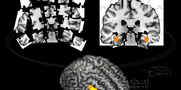 Article teaser image