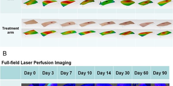 Article teaser image