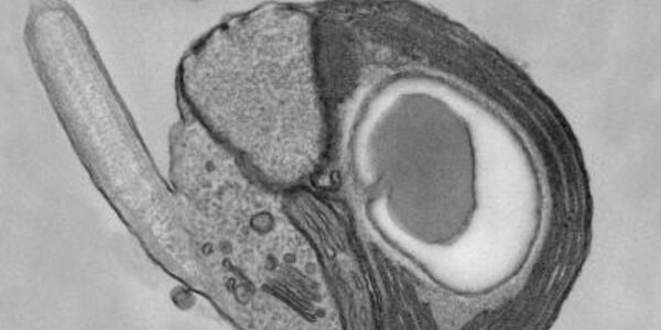 Article teaser image