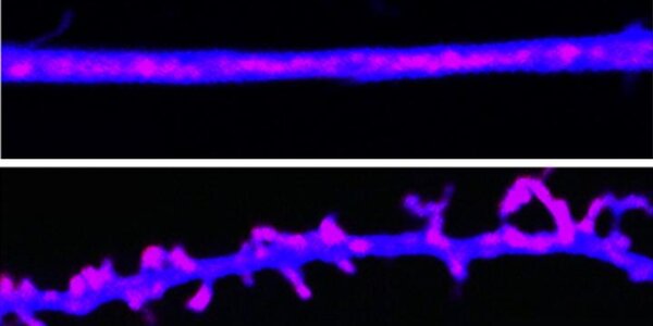 Article teaser image