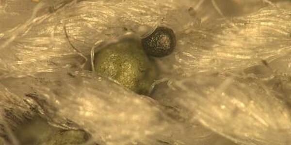 Article teaser image