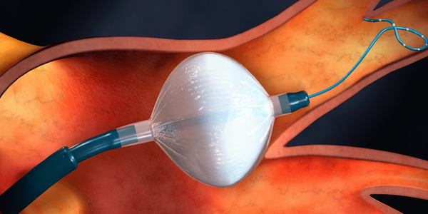 Article teaser image