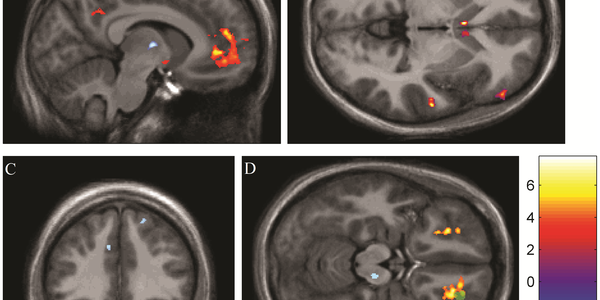 Article teaser image