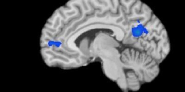 Article teaser image