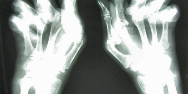 Article teaser image